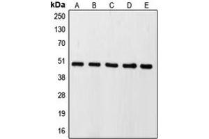 Western blot analysis of Caspase 9 expression in HeLa (A), HEK293T (B), SP2/0 (C), mouse kidney (D), rat lung (E) whole cell lysates. (Caspase 9 Antikörper  (Center))