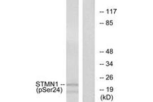 Western blot analysis of extracts from Jurkat cells treated with PMA 1ng/ml 15', using Stathmin 1 (Phospho-Ser24) Antibody. (Stathmin 1 Antikörper  (pSer25))