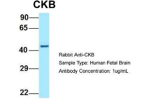Host: Rabbit  Target Name: CKB  Sample Tissue: Human Fetal Brain  Antibody Dilution: 1. (CKB Antikörper  (C-Term))