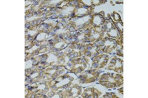 Immunohistochemistry of paraffin-embedded mouse stomach using TRMT2A antibody. (TRMT2A Antikörper  (C-Term))
