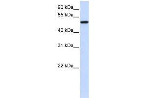 WB Suggested Anti-ZNF675 Antibody Titration: 0. (ZNF675 Antikörper  (N-Term))