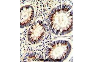 Immunohistochemistry (IHC) image for anti-Thymidylate Synthetase (TYMS) antibody (ABIN3002747) (TYMS Antikörper)