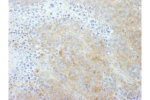 Immunohistochemistry (IHC) image for anti-Protein Tyrosine Phosphatase G1 (PTPN12) (AA 760-780) antibody (ABIN7449005) (PTPN12 Antikörper  (AA 760-780))