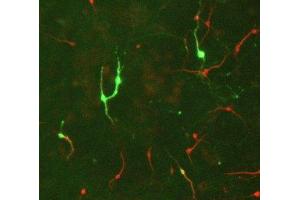Immunostaining of E17 rat midbrain mixed neuronal cultures showing TH positive neurons in green and MAP2 (ABIN361345) in red.