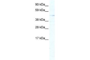 Western Blotting (WB) image for anti-Aristaless Related Homeobox (ARX) antibody (ABIN2461424) (Arx Antikörper)