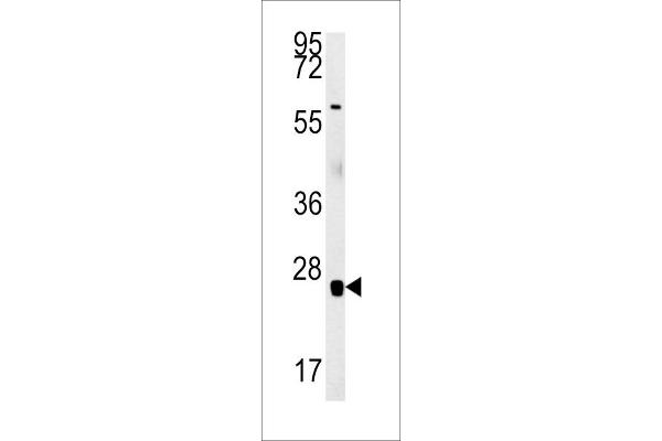 RBM24 Antikörper  (N-Term)