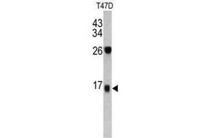 Image no. 1 for anti-Dermcidin (DCD) (C-Term) antibody (ABIN452901)