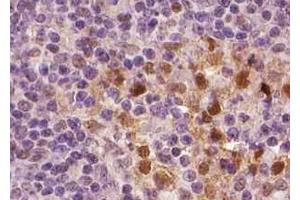 ABIN6267001 at 1/100 staining human Lymph node tissue sections by IHC-P. (Bcl-2 Antikörper  (Internal Region))