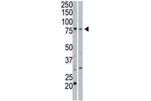 Western Blotting (WB) image for anti-Protein Kinase, CGMP-Dependent, Type I (PRKG1) (AA 629-660) antibody (ABIN3029798)
