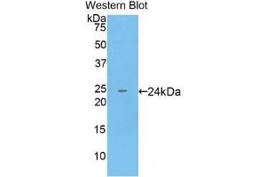Detection of Recombinant KRT18, Human using Monoclonal Antibody to Cytokeratin 18 (CK18) (Cytokeratin 18 Antikörper  (AA 238-396))