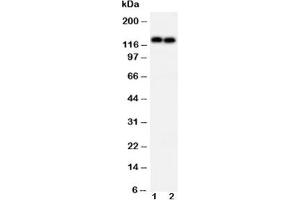 Western blot testing of N-Cadherin antibody and Lane 1:  MCF-7;  2: HeLa cell lysate (N-Cadherin Antikörper  (AA 701-714))