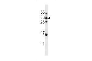 Western blot analysis in MDA-MB435 cell line lysates (35ug/lane). (ELOVL5 Antikörper  (C-Term))