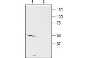 Western blot analysis of mouse brain membranes: - 1.