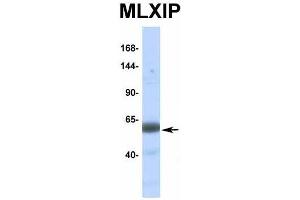 Host:  Rabbit  Target Name:  MLXIP  Sample Type:  Human Fetal Muscle  Antibody Dilution:  1. (MLXIP Antikörper  (Middle Region))