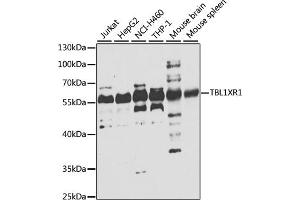 Western blot analysis of extracts of various cell lines, using TBL1XR1 antibody (ABIN6132718, ABIN6148894, ABIN6148896 and ABIN6223805) at 1:1000 dilution. (TBL1XR1 Antikörper  (AA 1-180))