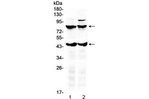 Western blot testing of 1) rat brain and 2) mouse brain lysate with TSH Receptor antibody. (TSHR, B Chain Antikörper  (AA 515-538))
