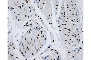 Image no. 7 for anti-Replication Protein A2, 32kDa (RPA2) antibody (ABIN1500733)