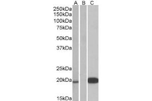 HEK293 lysate (10ug protein in RIPA buffer) over expressing Human UCN3 with DYKDDDDK tag probed with ABIN238662 (1ug/ml) in Lane A and probed with anti- DYKDDDDK Tag (1/3000) in lane C.
