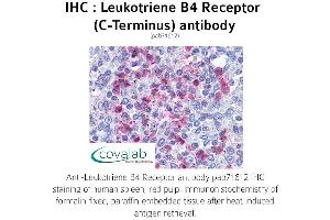 Image no. 1 for anti-Leukotriene B4 Receptor (LTB4R) (C-Term) antibody (ABIN1736425) (Leukotriene B4 Receptor/BLT Antikörper  (C-Term))