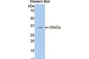 Western Blotting (WB) image for anti-Cadherin 1, Type 1, E-Cadherin (Epithelial) (CDH1) (AA 373-621) antibody (ABIN7430405)
