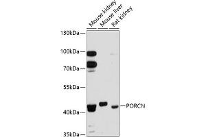 Western blot analysis of extracts of various cell lines, using PORCN antibody (ABIN6131340, ABIN6145972, ABIN6145974 and ABIN6215858) at 1:3000 dilution. (PORCN Antikörper  (AA 220-320))