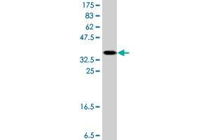 Western Blotting (WB) image for anti-NADH Dehydrogenase (Ubiquinone) Fe-S Protein 8, 23kDa (NADH-Coenzyme Q Reductase) (NDUFS8) (AA 27-136) antibody (ABIN561947)