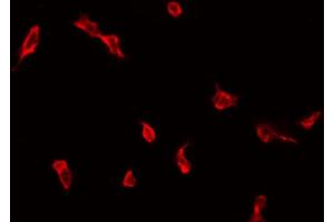 ABIN6272287 staining COLO205 by IF/ICC. (ZDHHC9 Antikörper  (C-Term))