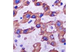 Immunohistochemistry (IHC) image for anti-Ribosomal Protein L14 (RPL14) antibody (ABIN7308284) (RPL14 Antikörper)