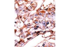 Image no. 2 for anti-V-Erb-A erythroblastic Leukemia Viral Oncogene Homolog 4 (Avian) (ERBB4) (pTyr1188) antibody (ABIN358140) (ERBB4 Antikörper  (pTyr1188))