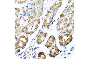 Immunohistochemistry of paraffin-embedded human stomach using HY antibody  at dilution of 1:100 (40x lens).