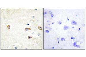 Immunohistochemistry (IHC) image for anti-CDC42 Binding Protein Kinase beta (DMPK-Like) (CDC42BPB) (C-Term) antibody (ABIN1850128) (CDC42BPB Antikörper  (C-Term))
