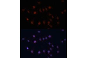 Immunofluorescence analysis of C6 cells using TOM70 antibody (ABIN1683089, ABIN3018839, ABIN3018840 and ABIN6220597) at dilution of 1:100. (TOM70 Antikörper  (AA 60-340))