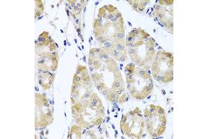 Immunohistochemistry of paraffin-embedded human gastric using CBR4 antibody at dilution of 1:100 (x40 lens). (CBR4 Antikörper)