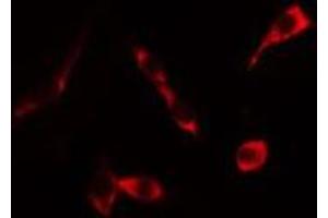 ABIN6276324 staining HeLa cells by IF/ICC. (KRT20 Antikörper  (C-Term))