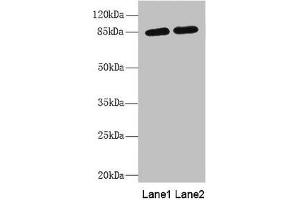 Western blot All lanes: MAGED1 antibody at 5. (MAGED1 Antikörper  (AA 579-778))
