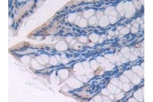 Immunohistochemistry (IHC) image for anti-Optineurin (OPTN) (AA 1-300) antibody (ABIN7435085)