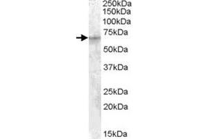IGF2BP2 polyclonal antibody  (1 ug/mL) staining of HepG2 cell lysate (35 ug protein in RIPA buffer).