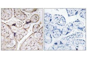 Immunohistochemistry (IHC) image for anti-Alkaline Ceramidase 3 (ACER3) (Internal Region) antibody (ABIN1850730) (ACER3 Antikörper  (Internal Region))