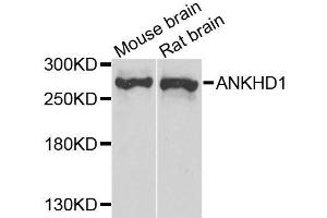Western blot analysis of extracts of various cell lines, using ANKHD1 antibody. (ANKHD1 Antikörper  (AA 1620-1800))