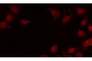 ABIN6269138 staining LOVO by IF/ICC. (SRF Antikörper  (N-Term))