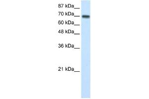 CARS antibody used at 1 ug/ml to detect target protein. (CARS Antikörper  (N-Term))