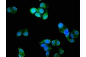 Immunofluorescence staining of Hela cells with ABIN7173574 at 1:200, counter-stained with DAPI. (TNNI3 Antikörper  (AA 2-210))