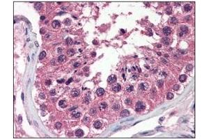Immunohistochemistry (IHC) image for anti-Uracil-DNA Glycosylase (UNG) (AA 1-313), (N-Term) antibody (ABIN317576) (UNG Antikörper  (N-Term))