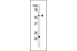 The anti-BACE2 Ctr Pab (ABIN390067 and ABIN2840591) is used in Western blot to detect BACE2 in HL60 cell lysate. (BACE2 Antikörper  (AA 336-365))