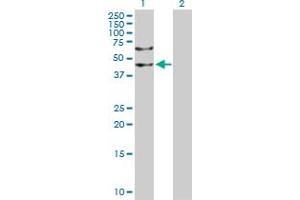 Western Blot analysis of LASS2 expression in transfected 293T cell line by LASS2 MaxPab polyclonal antibody. (Ceramide Synthase 2 Antikörper  (AA 1-380))