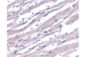 Image no. 1 for anti-Apoptotic Peptidase Activating Factor 1 (APAF1) (AA 12-28) antibody (ABIN205853) (APAF1 Antikörper  (AA 12-28))