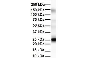 WB Suggested Anti-Tmed1 antibody Titration: 1 ug/mL Sample Type: Human liver (TMED1 Antikörper  (N-Term))