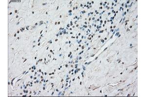 Immunohistochemical staining of paraffin-embedded Kidney tissue using anti-STAT1 mouse monoclonal antibody. (STAT1 Antikörper)