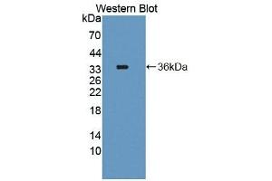 Detection of Recombinant TYMS, Human using Polyclonal Antibody to Thymidylate Synthetase (TYMS) (TYMS Antikörper  (AA 36-313))