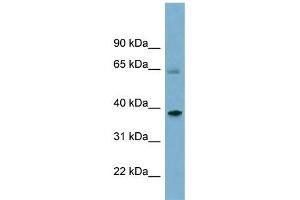 WB Suggested Anti-SNX7 Antibody Titration: 0. (Sorting Nexin 7 Antikörper  (Middle Region))